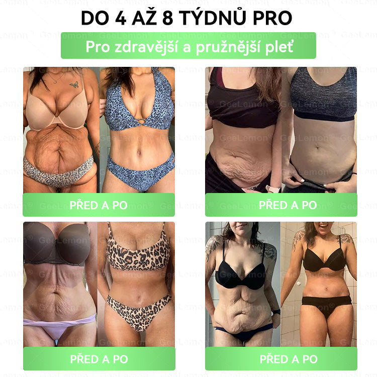 🌿🌿Doporučeno Fakultní nemocnicí Motol ·  Oficiální prodejna BENU | 🎁 𝐆𝐞𝑒𝑙𝑒𝐦𝐨𝐧® Glum𝐚𝐬𝐞tide 8 v 1 – Zeštíhlující nano mikrojihlový náplast 🇨🇿 Jen 1× denně ✅ Viditelné změny za 7 dní – na obezitu, kardiovaskulární zdraví, diabetes a kloubní problémy