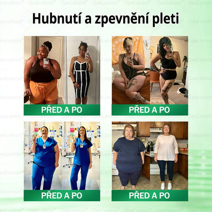🌿🌿Doporučeno Fakultní nemocnicí Motol ·  Oficiální prodejna BENU | 🎁 𝐆𝐞𝑒𝑙𝑒𝐦𝐨𝐧® Glum𝐚𝐬𝐞tide 8 v 1 – Zeštíhlující nano mikrojihlový náplast 🇨🇿 Jen 1× denně ✅ Viditelné změny za 7 dní – na obezitu, kardiovaskulární zdraví, diabetes a kloubní problémy